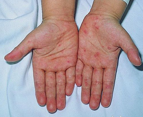 3720.tmp.jpg 3720.tmp.jpg