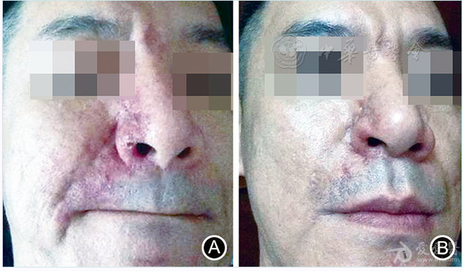 57de436f9c8bc_o.png 57de436f9c8bc_o.png