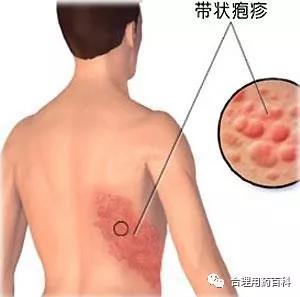 微信圖片_20180401212220.jpg 微信圖片_20180401212220.jpg