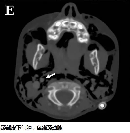 微信圖片_20200425210558.jpg 微信圖片_20200425210558.jpg